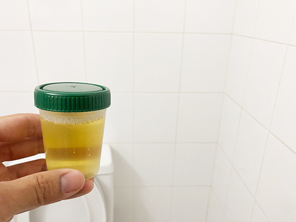 full urine sample cup with quick fix synthetic urine at a drug testing facility